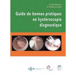 Guide de bonnes pratiques en hystéroscopie diagnostique