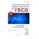 Tout ce que vous avez toujours voulu savoir sur l'ECG