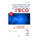 Tout ce que vous avez toujours voulu savoir sur l'ECG